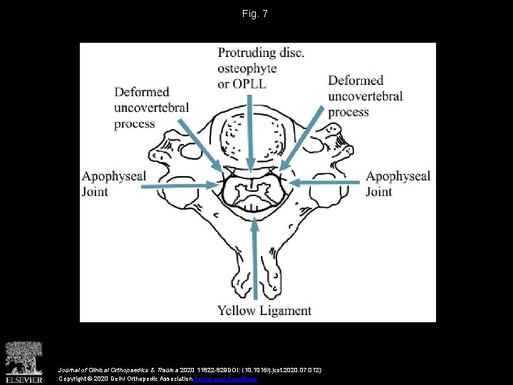 Fig. 7 Journal of Clinical Orthopaedics & Trauma 2020 11822 -829 DOI: (10. 1016/j.