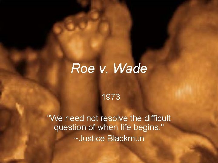 Roe v. Wade 1973 "We need not resolve the difficult question of when life