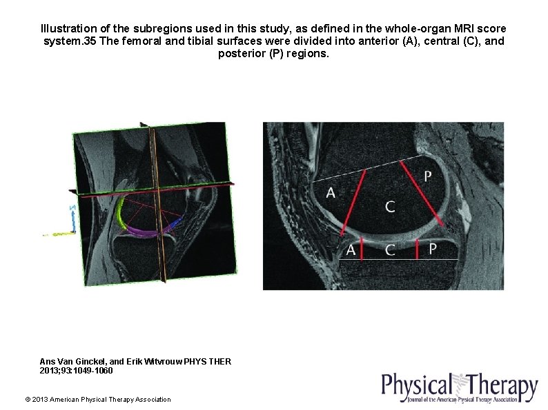 Illustration of the subregions used in this study, as defined in the whole-organ MRI