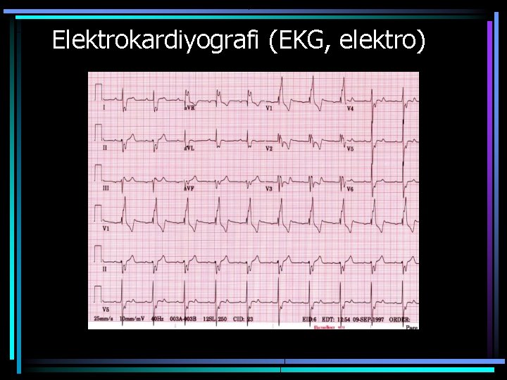 Elektrokardiyografi (EKG, elektro) 