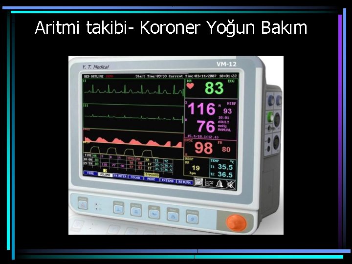 Aritmi takibi- Koroner Yoğun Bakım 