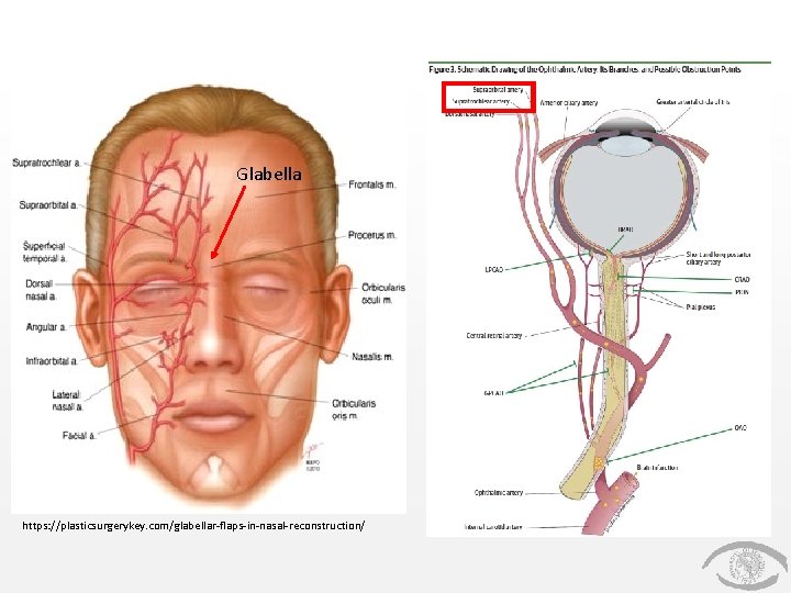 Glabella https: //plasticsurgerykey. com/glabellar-flaps-in-nasal-reconstruction/ 