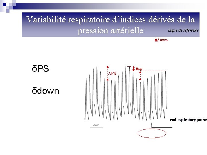 Variabilité respiratoire d’indices dérivés de la Ligne de référence pression artérielle down δPS up