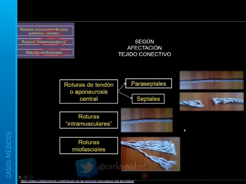 https: //www. santandermsk. com/manejo-de-las-lesiones-musculares-del-deportista/ 