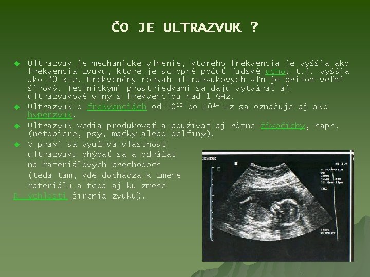 ČO JE ULTRAZVUK ? u u R Ultrazvuk je mechanické vlnenie, ktorého frekvencia je