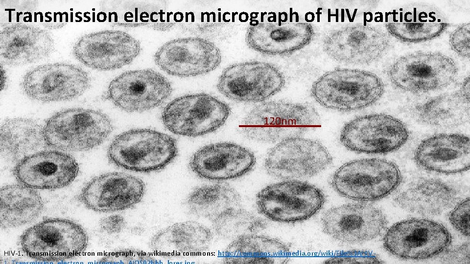 Transmission electron micrograph of HIV particles. 120 nm HIV-1. Transmission electron micrograph, via wikimedia