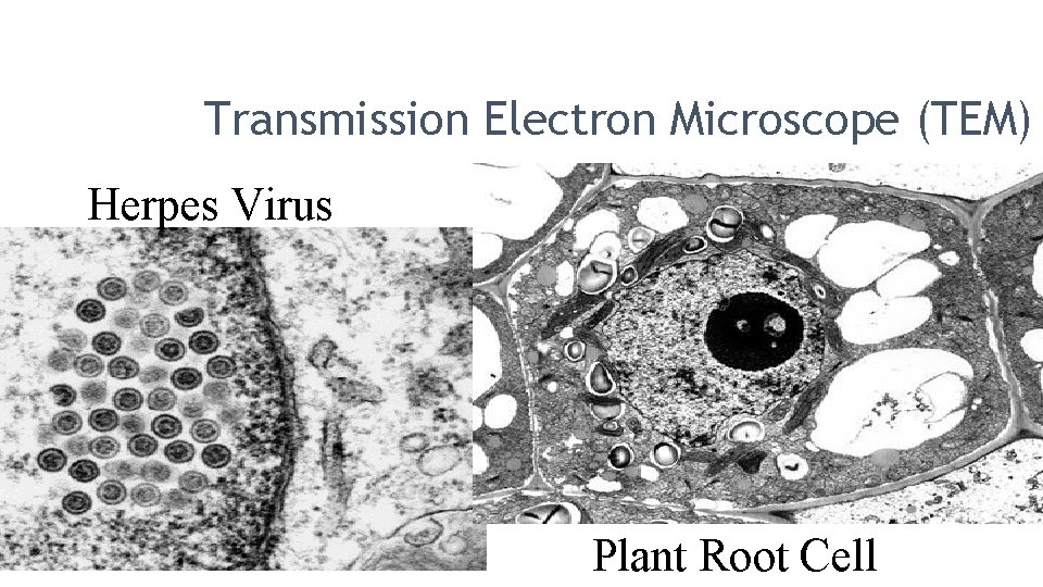 Transmission Electron Microscope (TEM) Herpes Virus Plant Root Cell 