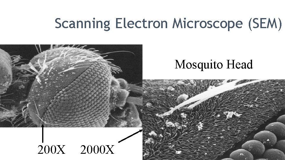 Scanning Electron Microscope (SEM) Mosquito Head 200 X 2000 X 