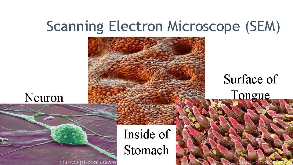 Scanning Electron Microscope (SEM) Surface of Tongue Neuron Inside of Stomach 