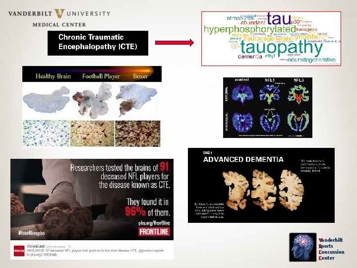 Vanderbilt Sports Concussion Center 