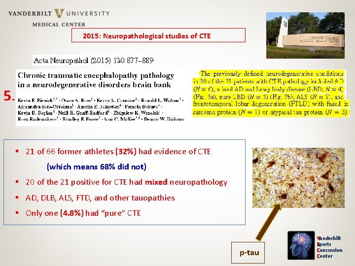 2015: Neuropathological studies of CTE 5. 21 of 66 former athletes (32%) had evidence