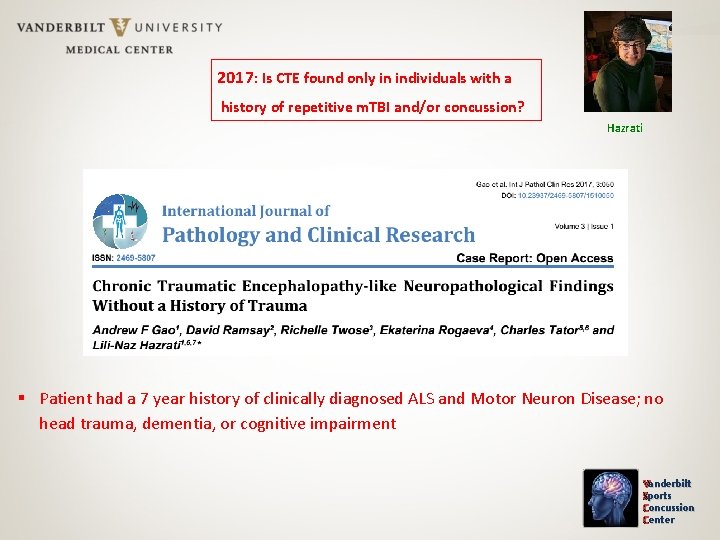 2017: Is CTE found only in individuals with a history of repetitive m. TBI