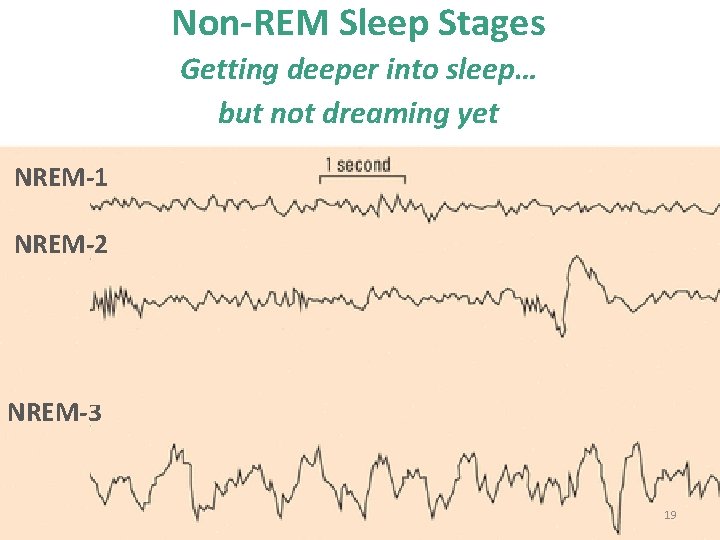 Non-REM Sleep Stages Getting deeper into sleep… but not dreaming yet NREM-1 NREM-2 NREM-3