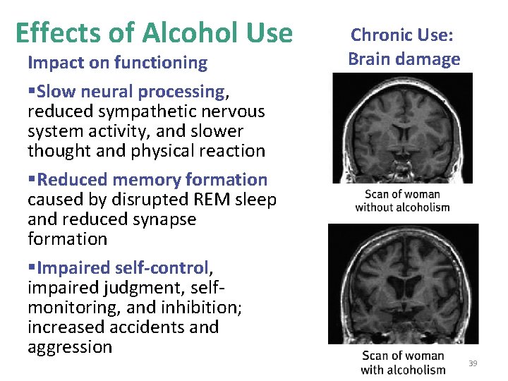 Effects of Alcohol Use Impact on functioning §Slow neural processing, reduced sympathetic nervous system