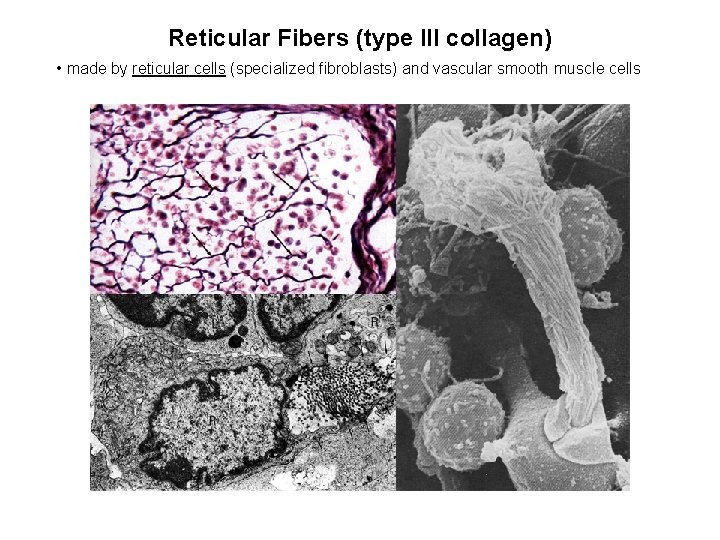 Reticular Fibers (type III collagen) • made by reticular cells (specialized fibroblasts) and vascular