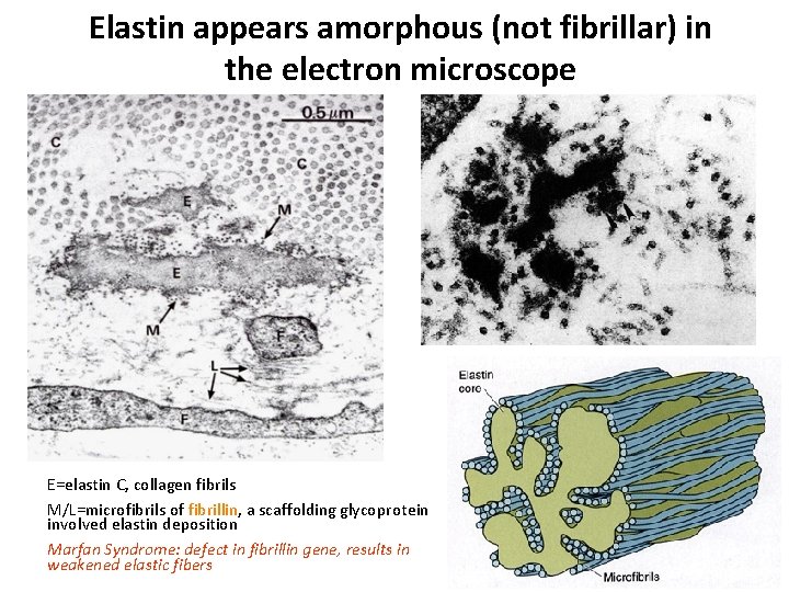 Elastin appears amorphous (not fibrillar) in the electron microscope E=elastin C, collagen fibrils M/L=microfibrils