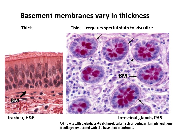 Basement membranes vary in thickness Thick Thin -- requires special stain to visualize BM