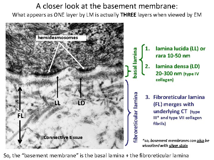 A closer look at the basement membrane: What appears as ONE layer by LM