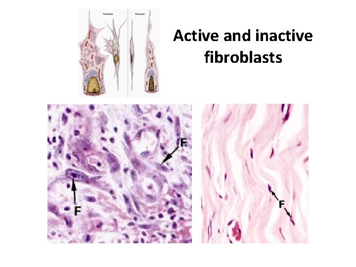 Active and inactive fibroblasts 