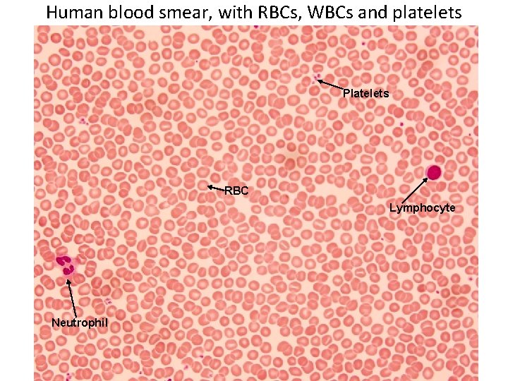 Human blood smear, with RBCs, WBCs and platelets Platelets RBC Lymphocyte Neutrophil 