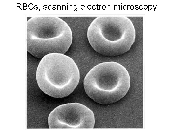 RBCs, scanning electron microscopy 