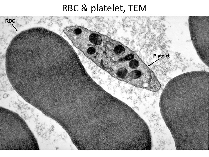 RBC & platelet, TEM RBC Platelet 