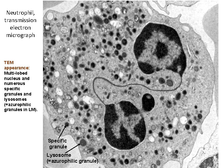 Neutrophil, transmission electron micrograph TEM appearance: Multi-lobed nucleus and numerous specific granules and lysosomes