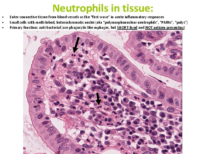 • • • Neutrophils in tissue: Enter connective tissue from blood vessels as