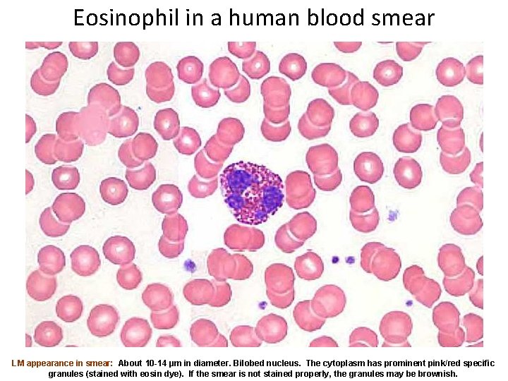 Eosinophil in a human blood smear LM appearance in smear: About 10 -14 µm