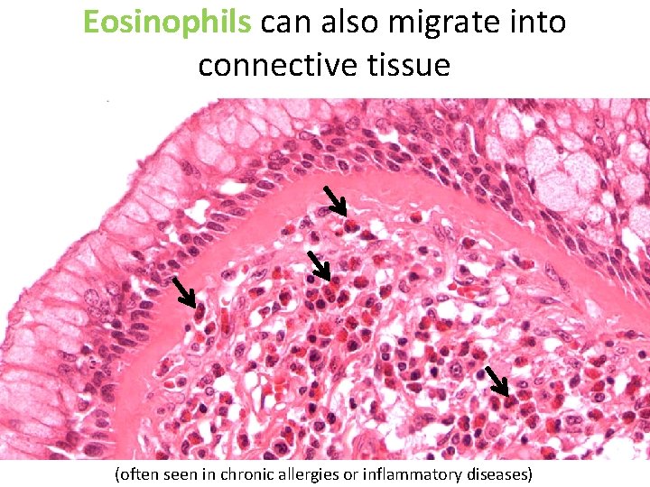 Eosinophils can also migrate into connective tissue (often seen in chronic allergies or inflammatory