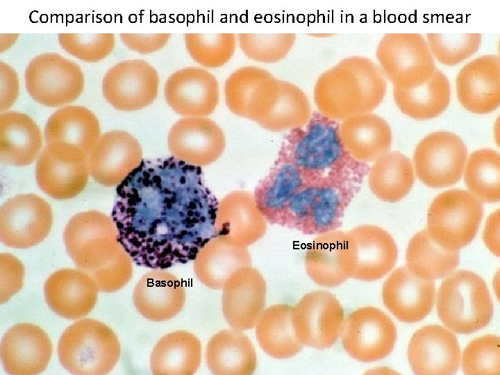 Comparison of basophil and eosinophil in a blood smear Eosinophil Basophil 