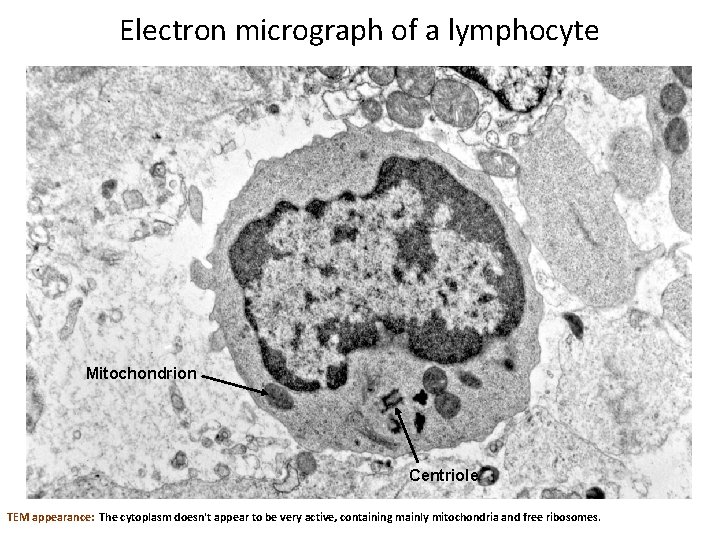 Electron micrograph of a lymphocyte Mitochondrion Centriole TEM appearance: The cytoplasm doesn't appear to
