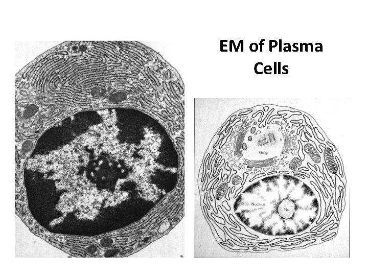 EM of Plasma Cells 