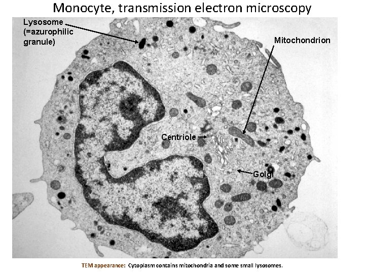 Monocyte, transmission electron microscopy Lysosome (=azurophilic granule) Mitochondrion Centriole Golgi TEM appearance: Cytoplasm contains
