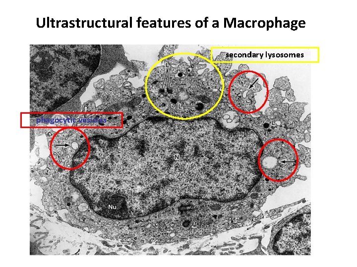 Ultrastructural features of a Macrophage secondary lysosomes phagocytic vesicles 