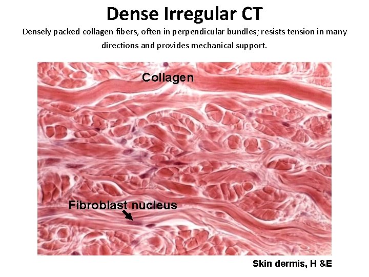 Dense Irregular CT Densely packed collagen fibers, often in perpendicular bundles; resists tension in