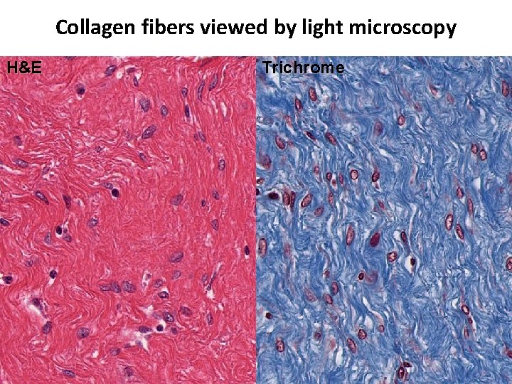 Collagen fibers viewed by light microscopy H&E Trichrome 