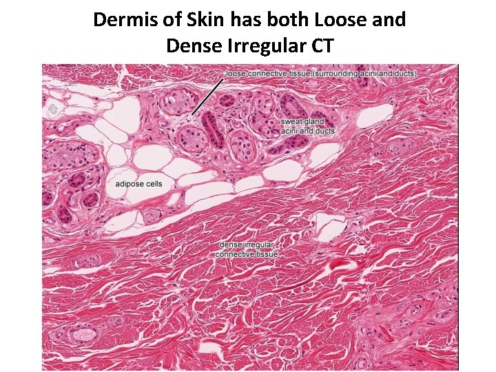 Dermis of Skin has both Loose and Dense Irregular CT Loose CT sweat gland