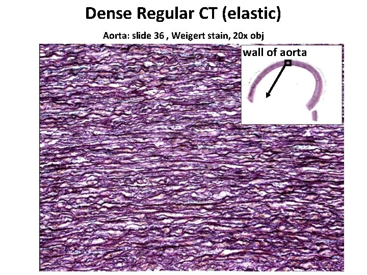 Dense Regular CT (elastic) Aorta: slide 36 , Weigert stain, 20 x obj wall