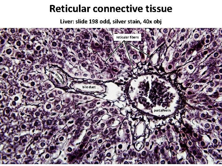 Reticular connective tissue Liver: slide 198 odd, silver stain, 40 x obj reticular fibers