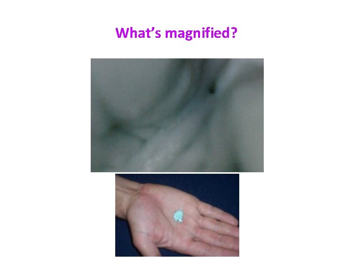 What’s magnified? 
