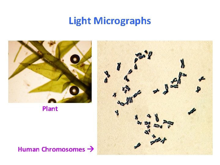 Light Micrographs Plant Human Chromosomes 