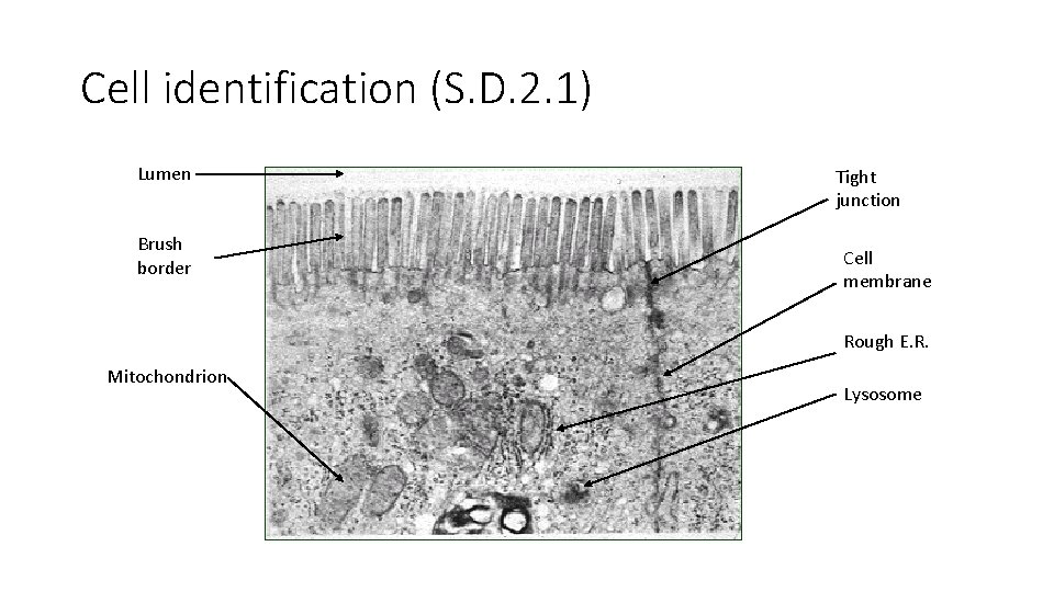Cell identification (S. D. 2. 1) Lumen Brush border Tight junction Cell membrane Rough