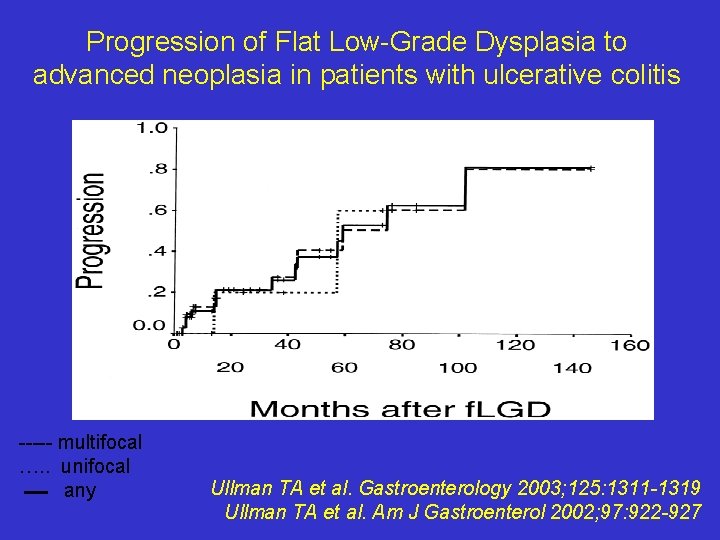 Progression of Flat Low-Grade Dysplasia to advanced neoplasia in patients with ulcerative colitis -----