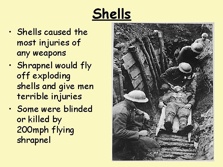 Shells • Shells caused the most injuries of any weapons • Shrapnel would fly