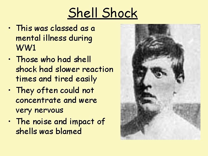Shell Shock • This was classed as a mental illness during WW 1 •