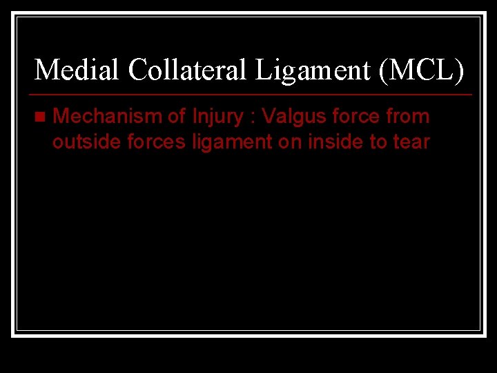 Medial Collateral Ligament (MCL) n Mechanism of Injury : Valgus force from outside forces