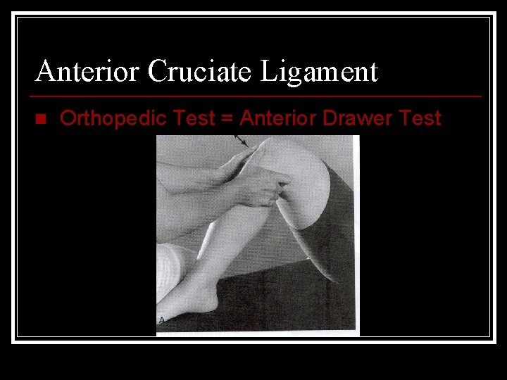 Anterior Cruciate Ligament n Orthopedic Test = Anterior Drawer Test 