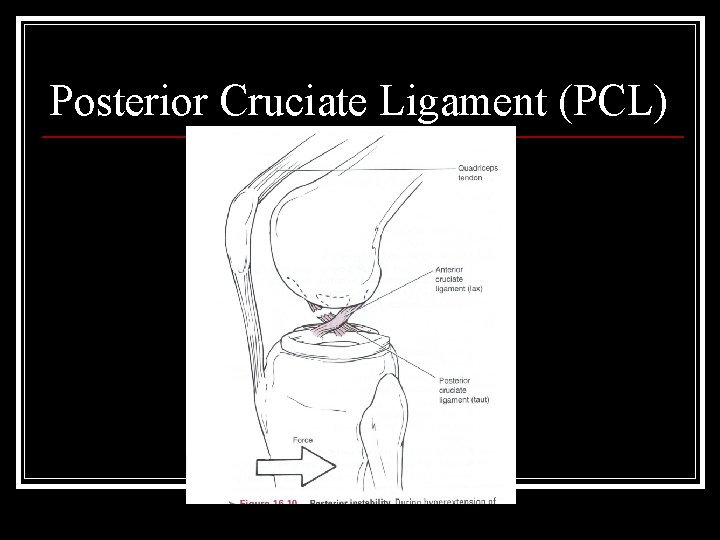 Posterior Cruciate Ligament (PCL) 