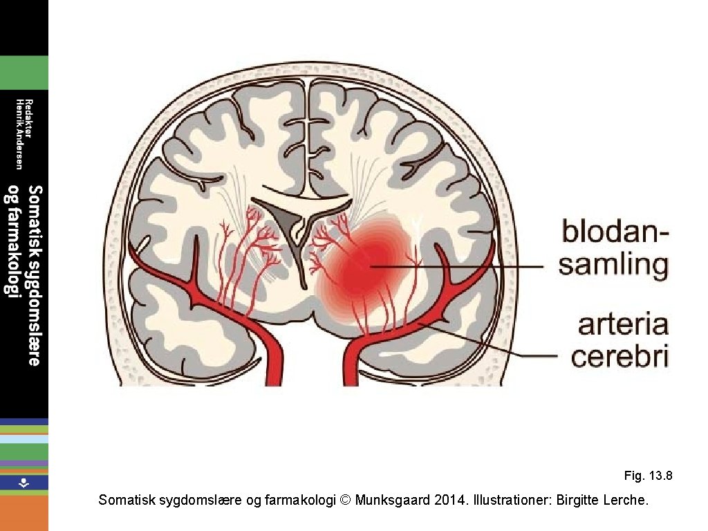 Fig. 13. 8 Somatisk sygdomslære og farmakologi © Munksgaard 2014. Illustrationer: Birgitte Lerche. 